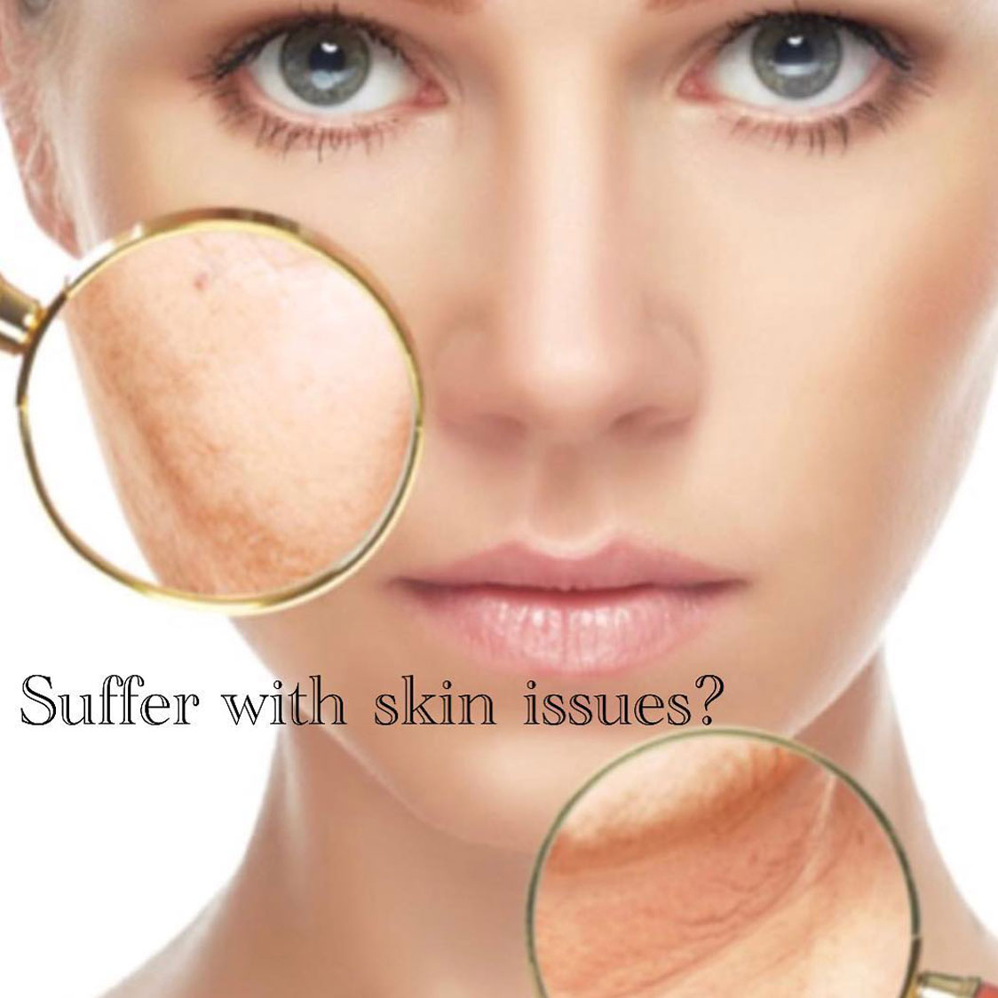 skin issues kara o'donnell wellness nutrition midleton